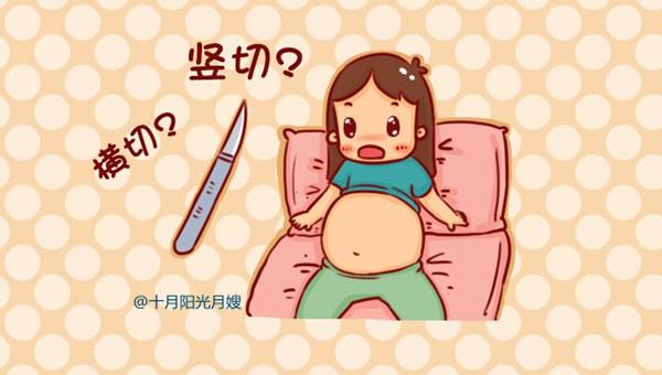 剖宮產(chǎn)選擇橫剖還是豎剖 十月陽光 剖宮產(chǎn)選擇橫剖還是豎剖 十月陽光